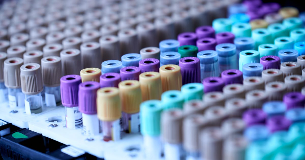 Blood alcohol testing for court and legal… Drug Testing Clinics