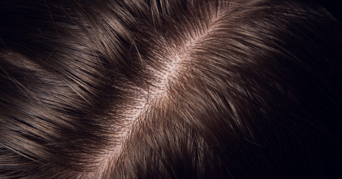 How accurate is hair drug testing? Crystal Health