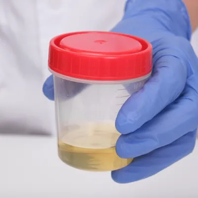 Urine point of care drug test medium