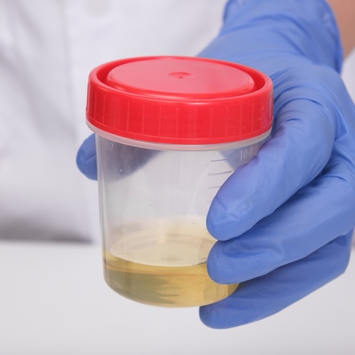 DNA Testing, Drug Testing & Occupational Health UK |… | Crystal Health