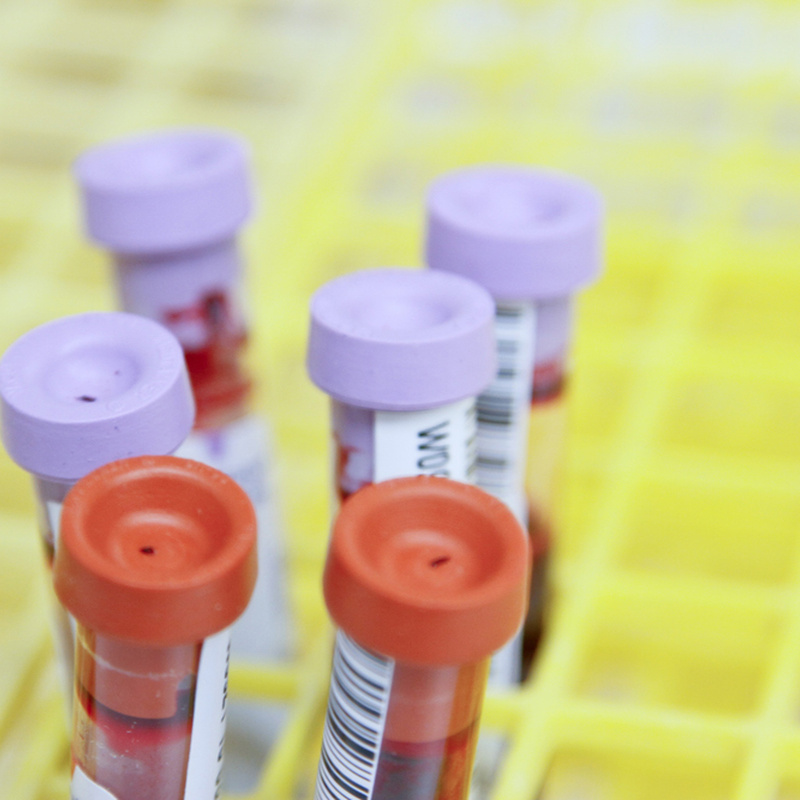Blood alcohol testing Court approved ISO 17025… Crystal Health