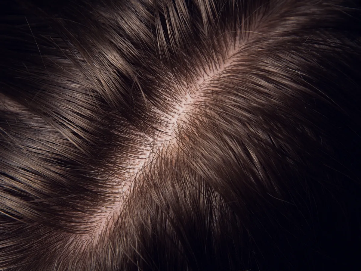 Head hair drug testing medium