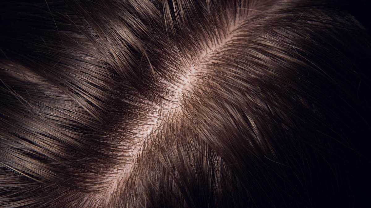 How accurate is hair drug testing? Crystal Health