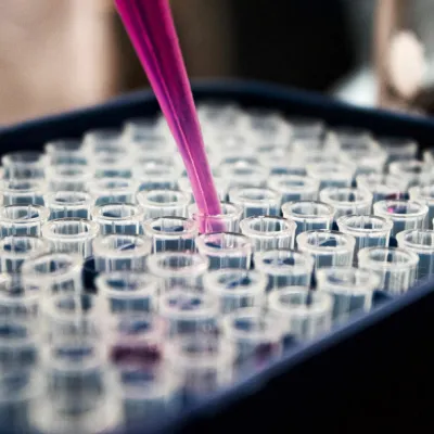 London drug and alcohol testing prices