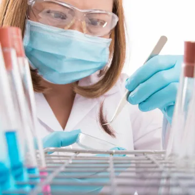 London hair alcohol test