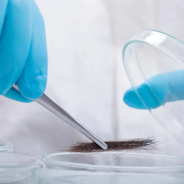 London hair drug testing services