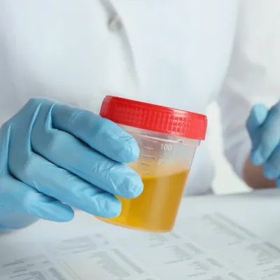 London POC urine drug screen