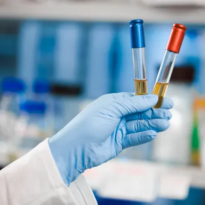 London Urine laboratory drug testing