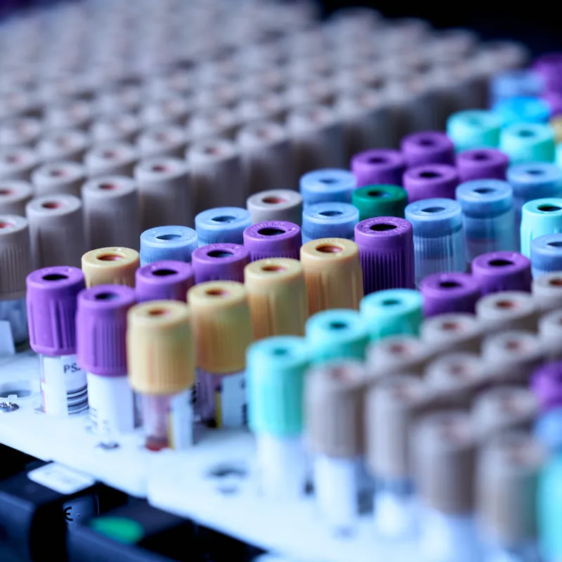 Blood alcohol tests