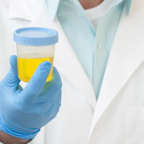 Urine POC drug testing